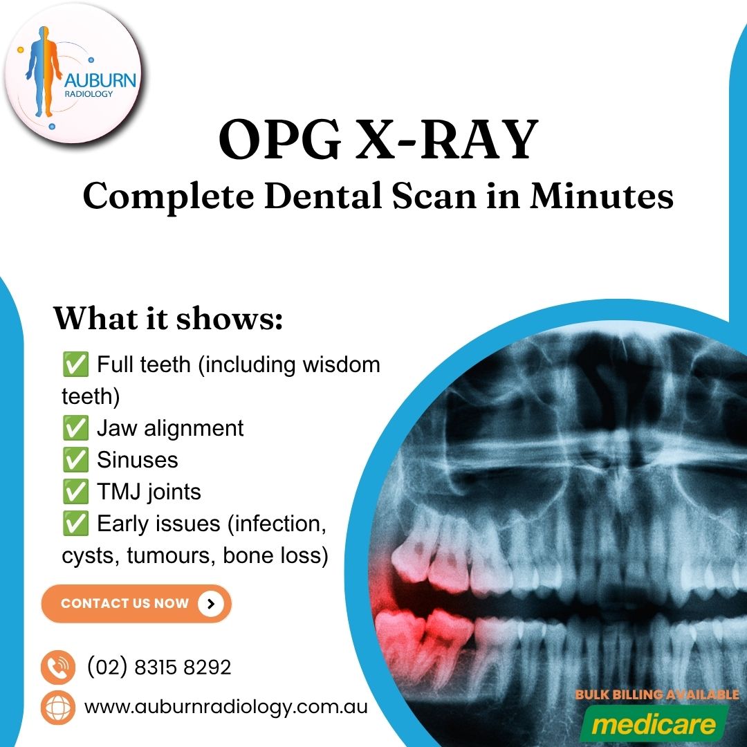  OPG X-RAY: A Complete Dental Scan in Minutes at Auburn Radiology. (02) 8315 8292