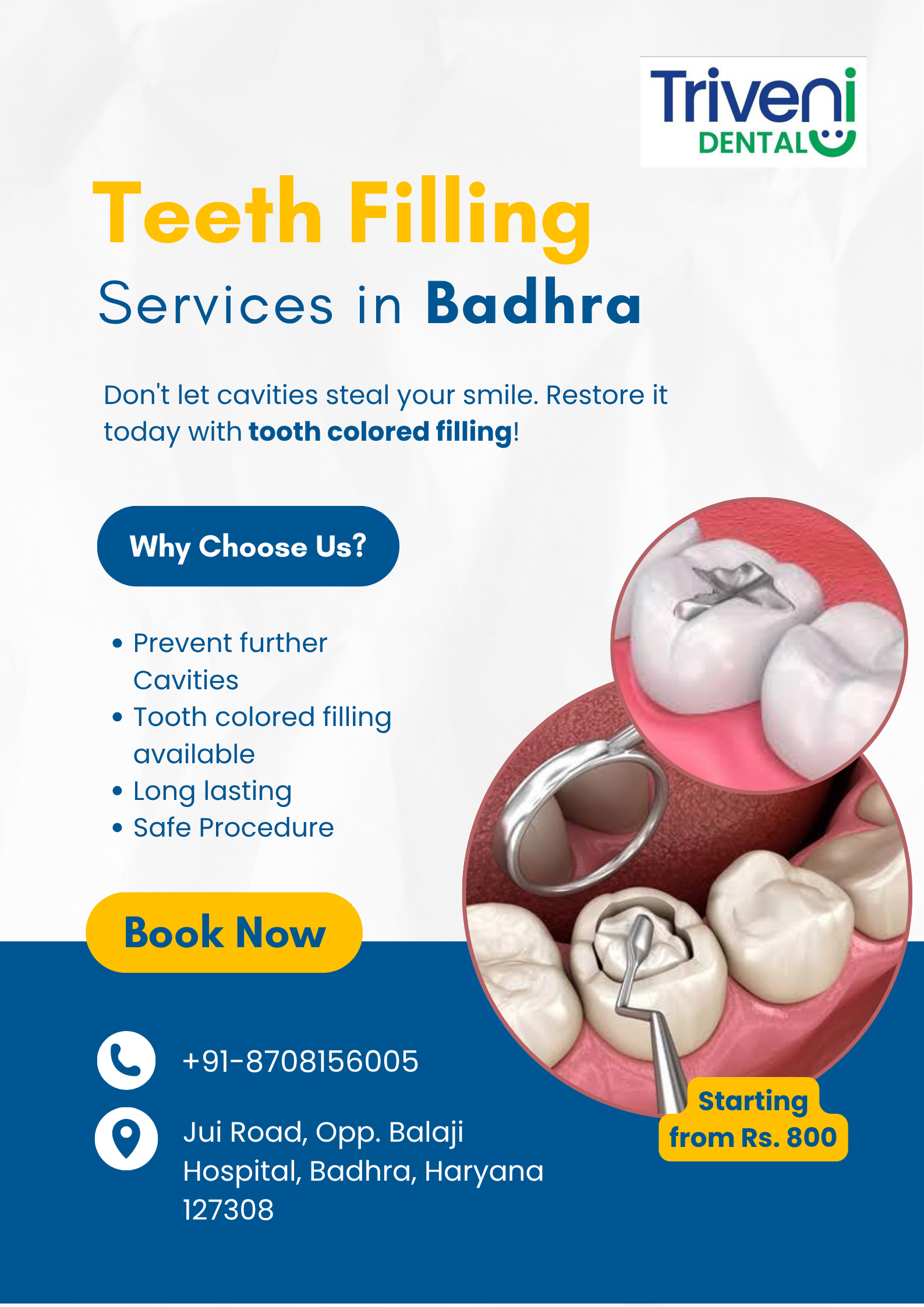  Tooth Filling Services in Badhra | Triveni Dental
