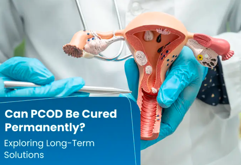  Effective Long-Term Solutions for Managing PCOD Symptoms