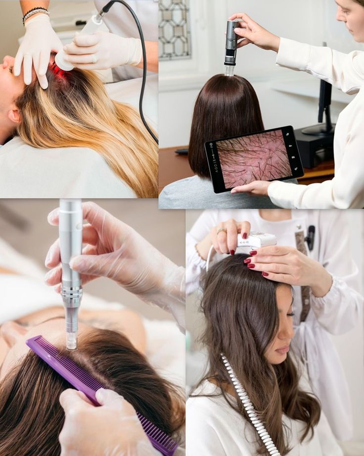  Hair Treatment Clinics