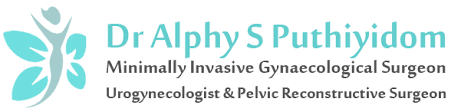  Fibroid specialist dubai
