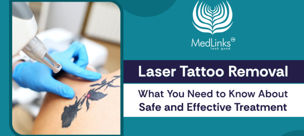  Laser Tattoo Removal in Gurgaon | MedLinks