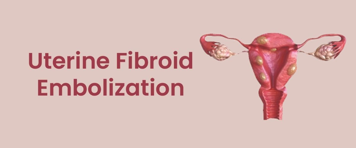  Uterine Fibroid Embolization Cost in India – Treatment Guide