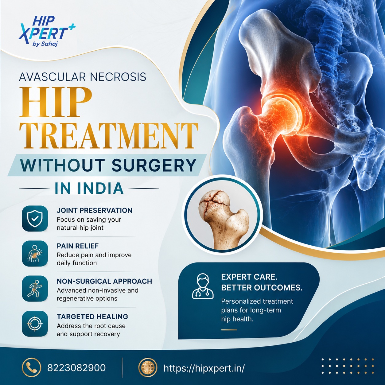  Avascular Necrosis Hip Treatment Without Surgery in India