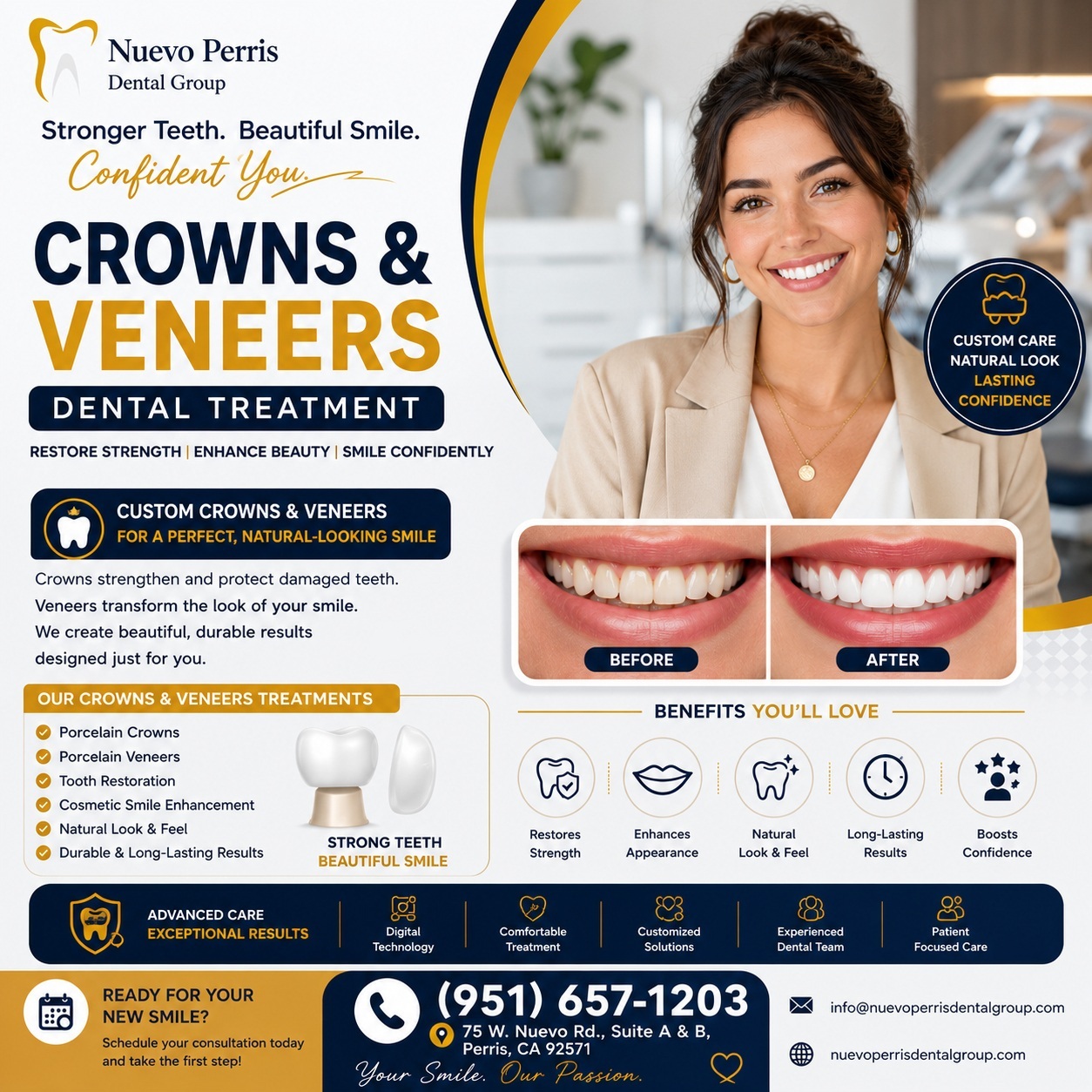  Crowns & Veneers Dental Treatment in Menifee | Nuevo