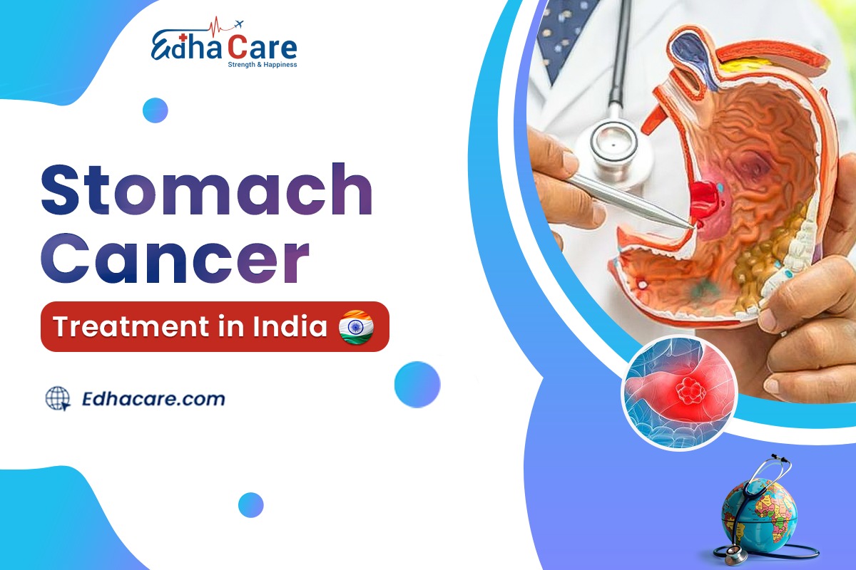  Stomach Cancer Treatment in India