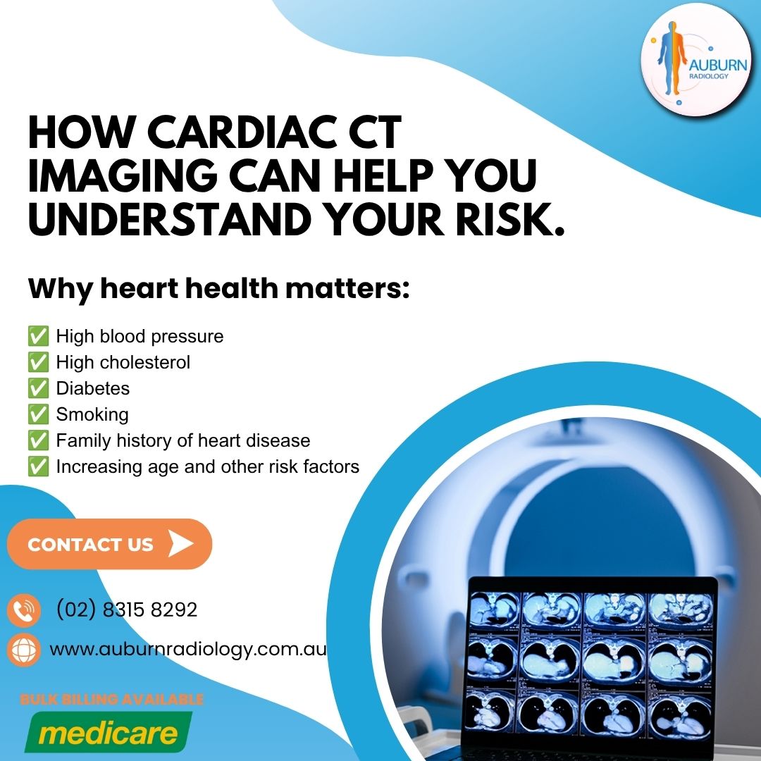  How Cardiac CT Imaging Can Help You Understand Your Risk at Auburn Radiology. (02) 8315 8292
