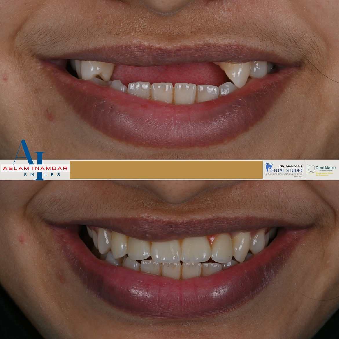  Dentist in Mumbai Redefining Smiles with Digital Precision