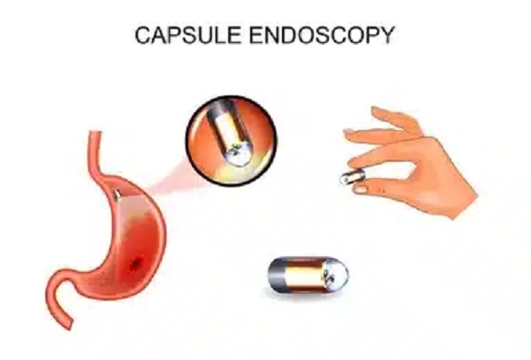  Endoscopy in Ahmedabad - Endoscopy Doctor - NIG