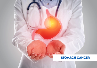  Symptoms of Stomach Cancer