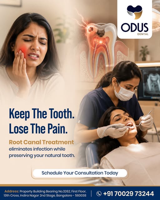  Best Root Canal Treatment in Indiranagar – ODUS Dental, Bangalore