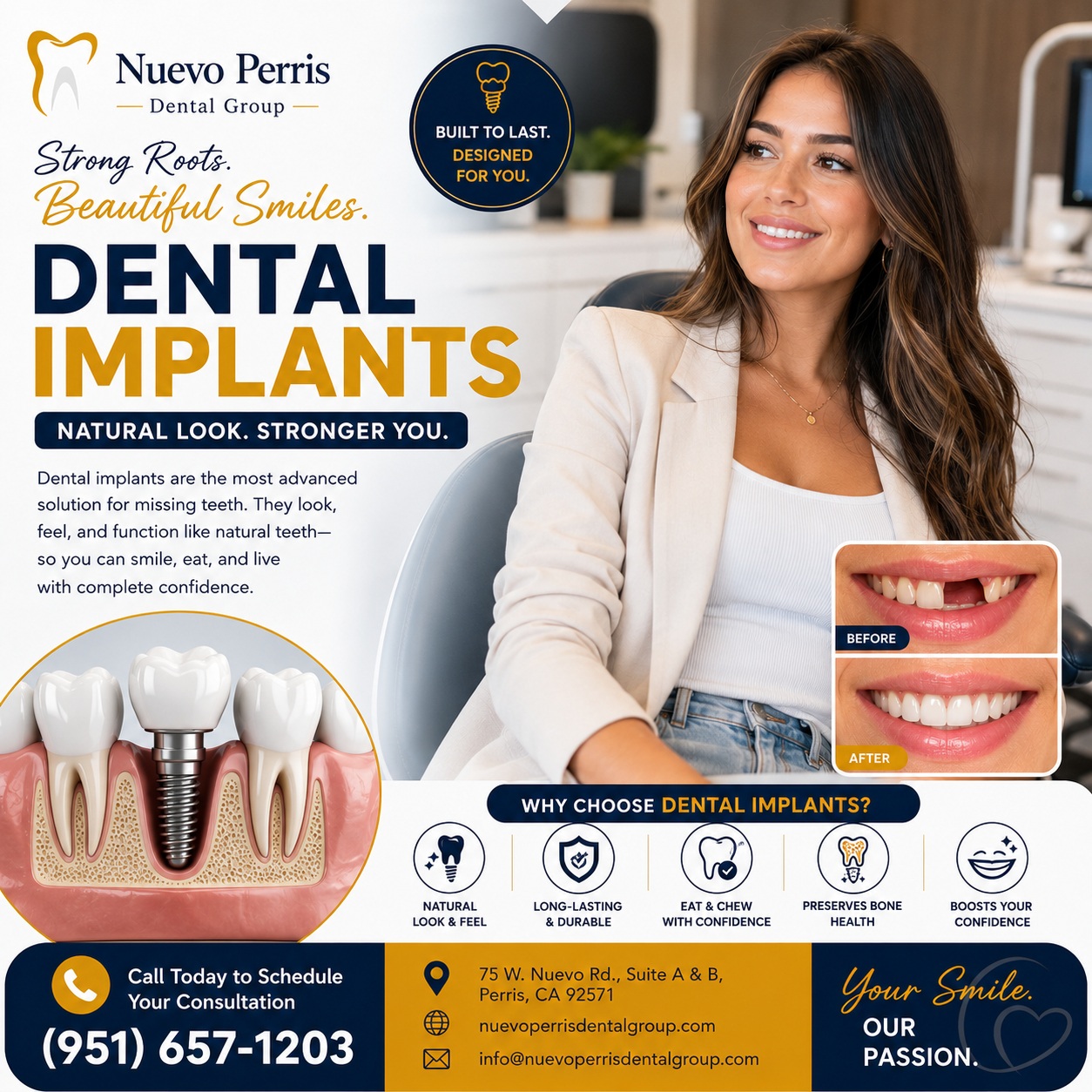  Dental Implants Treatment in Perris | Nuevo Perris Dental