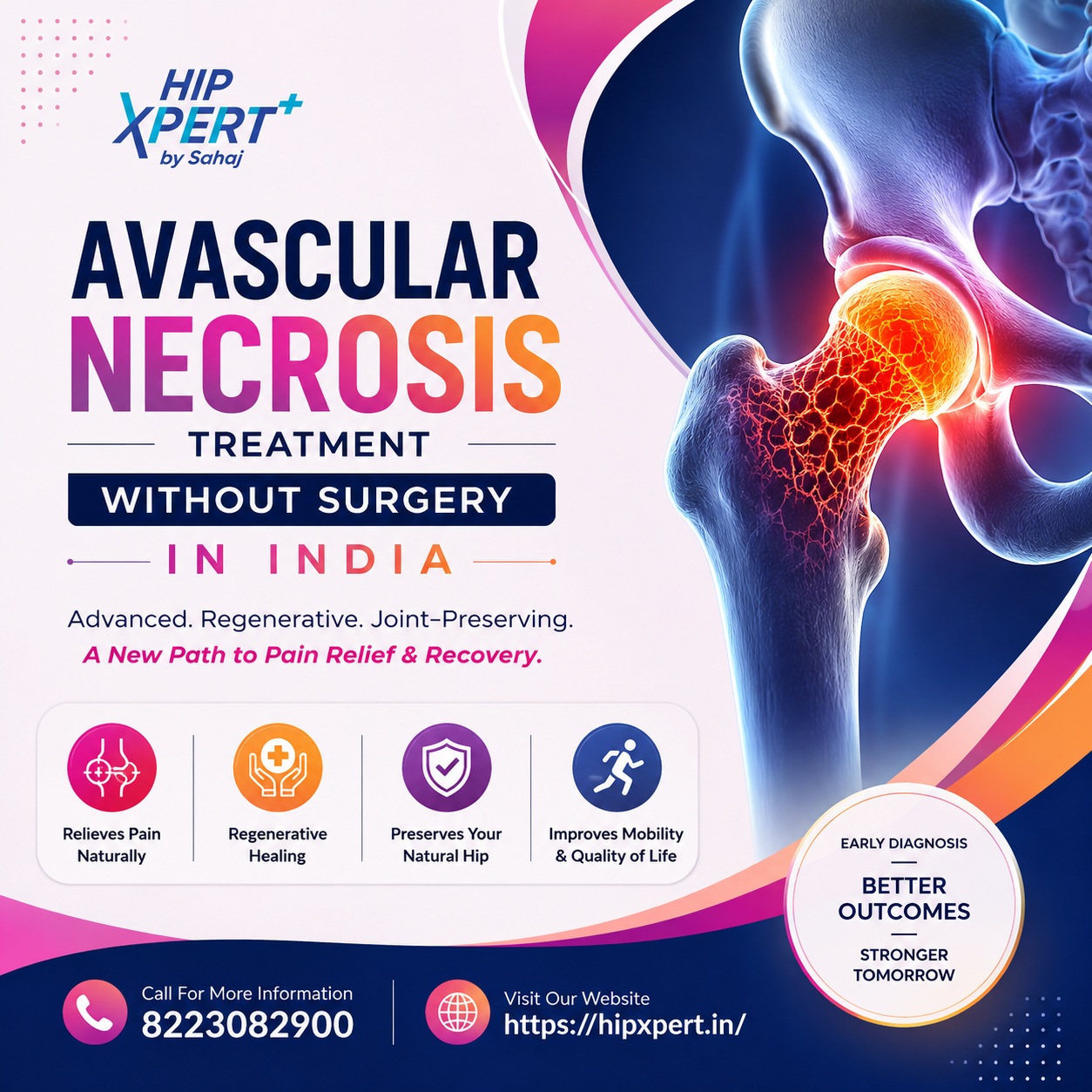  Avascular Necrosis Treatment Without Surgery in India - Hip Xpert