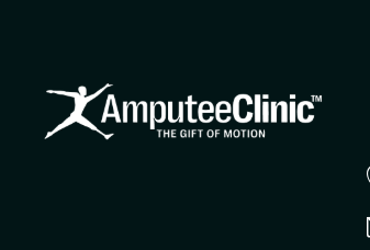  Prosthesis Above Knee for Personalized Mobility