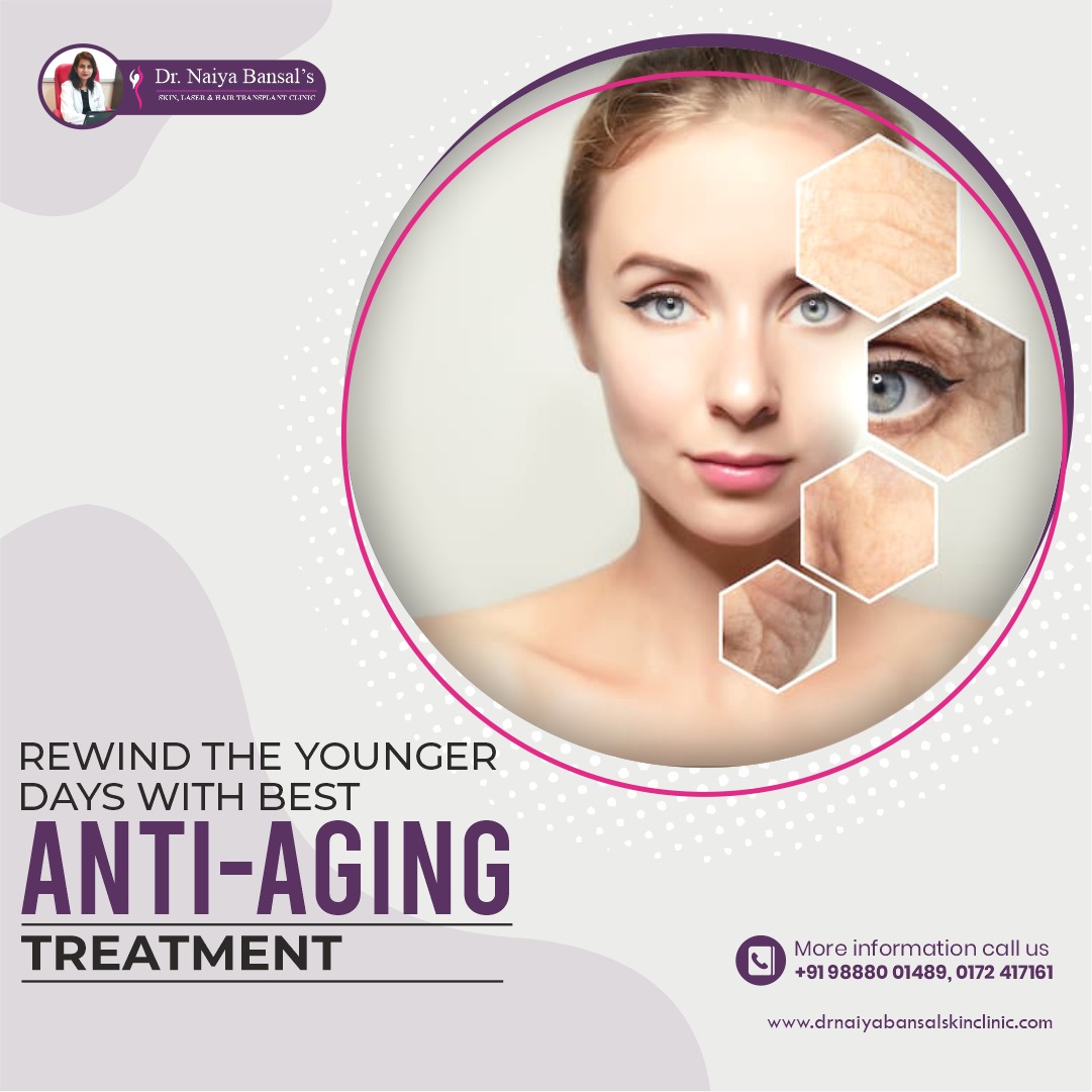  Dr Naiya Bansal - Skin Specialist in Chandigarh