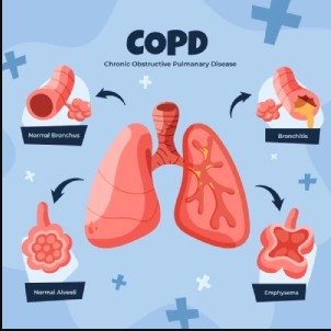  Comprehensive Lung Biopsy & Pulmonary Diagnosis Expert in Kota, Rajasthan – Dr. Sheetu Singh