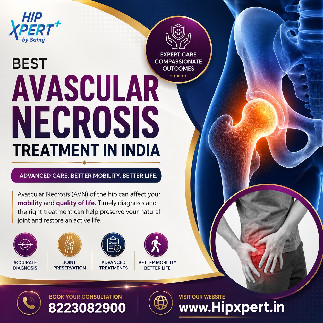  Best Avascular Necrosis Treatment in India - Hip Xpert