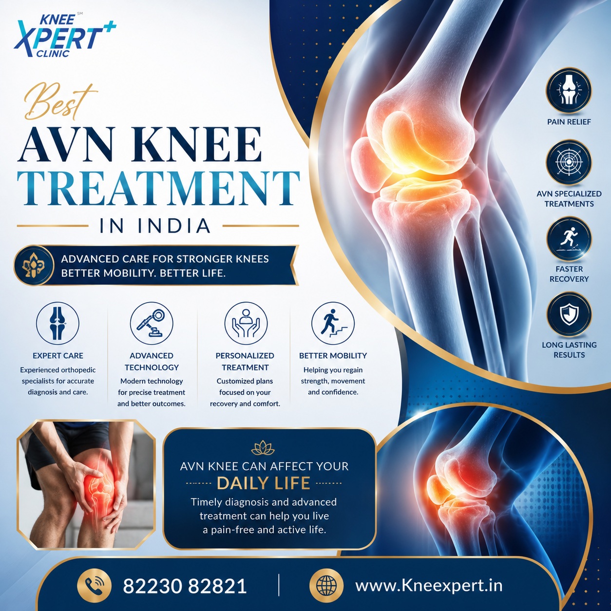  Best AVN Knee Treatment in India - Knee Xpert