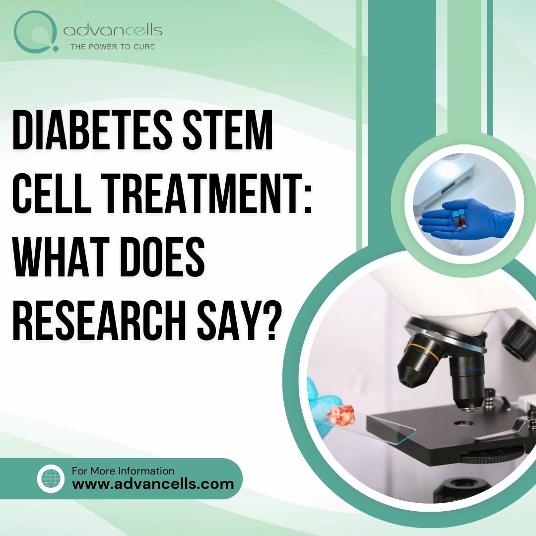  Diabetes Stem Cell Treatment: What Does Research Say?