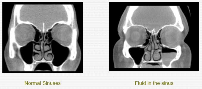  Sinuses pain doctor near me
