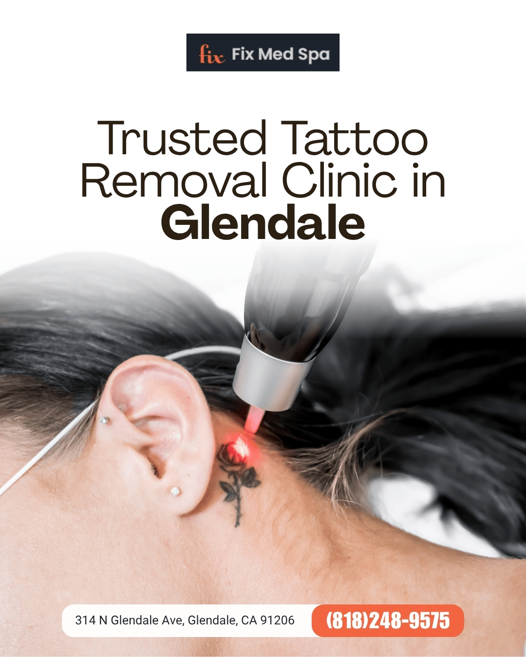  Advanced PicoWay Tattoo Removal in Glendale