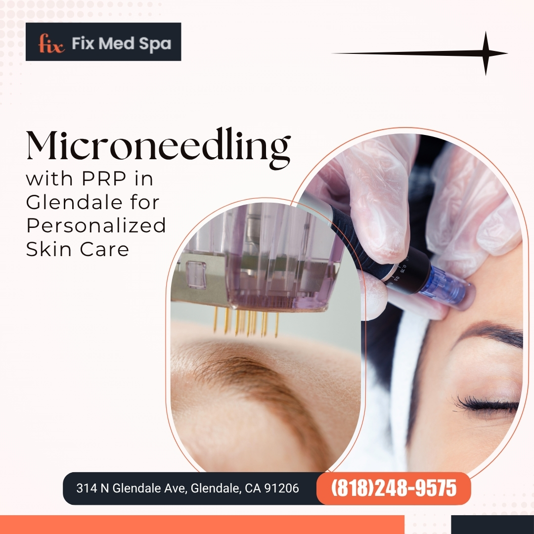  Microneedling with PRP in Glendale for Personalized Skin Care