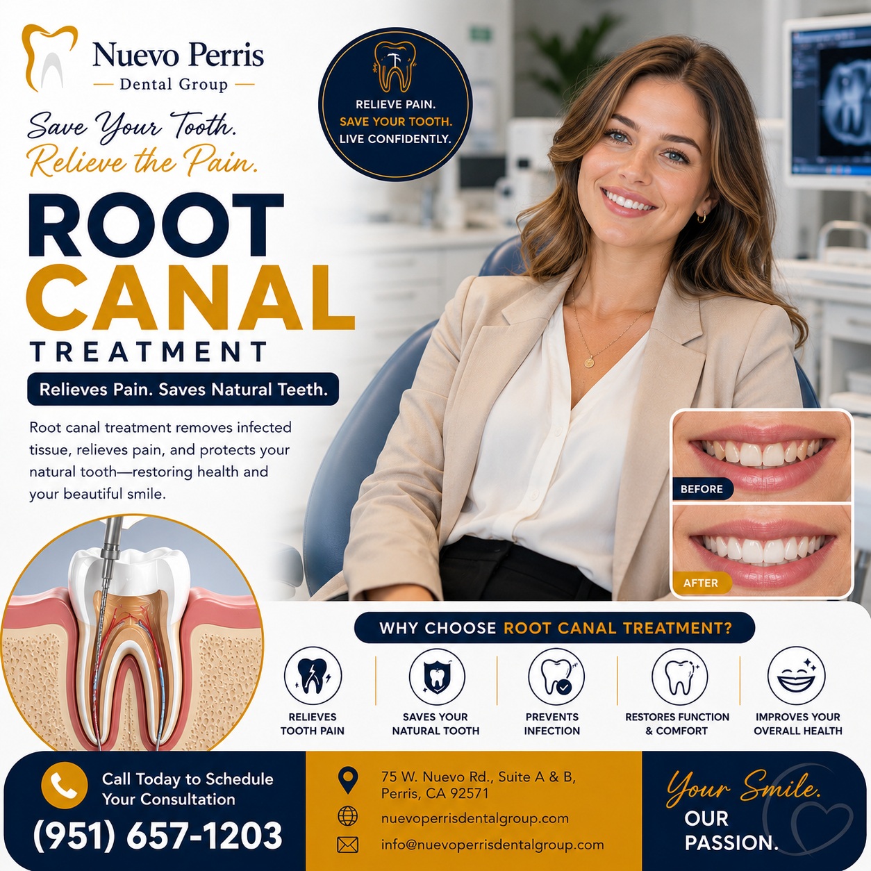  Expert Root Canal Treatment in Homeland | Nuevo Perris Dental