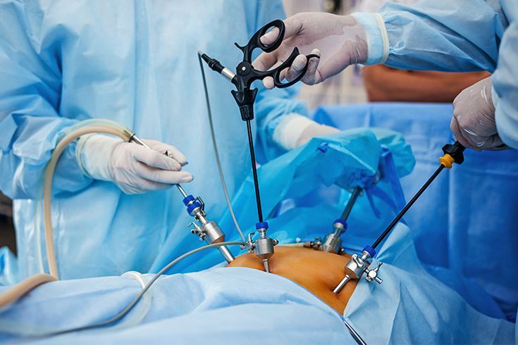  Laparoscopic Surgeons