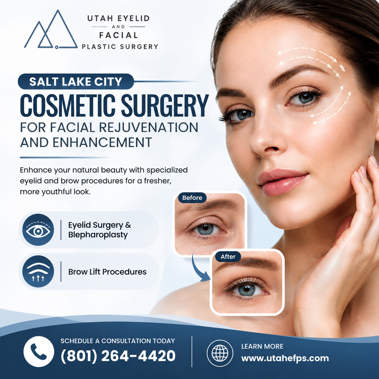  Salt Lake City Cosmetic Surgery for Facial Rejuvenation and Enhancement