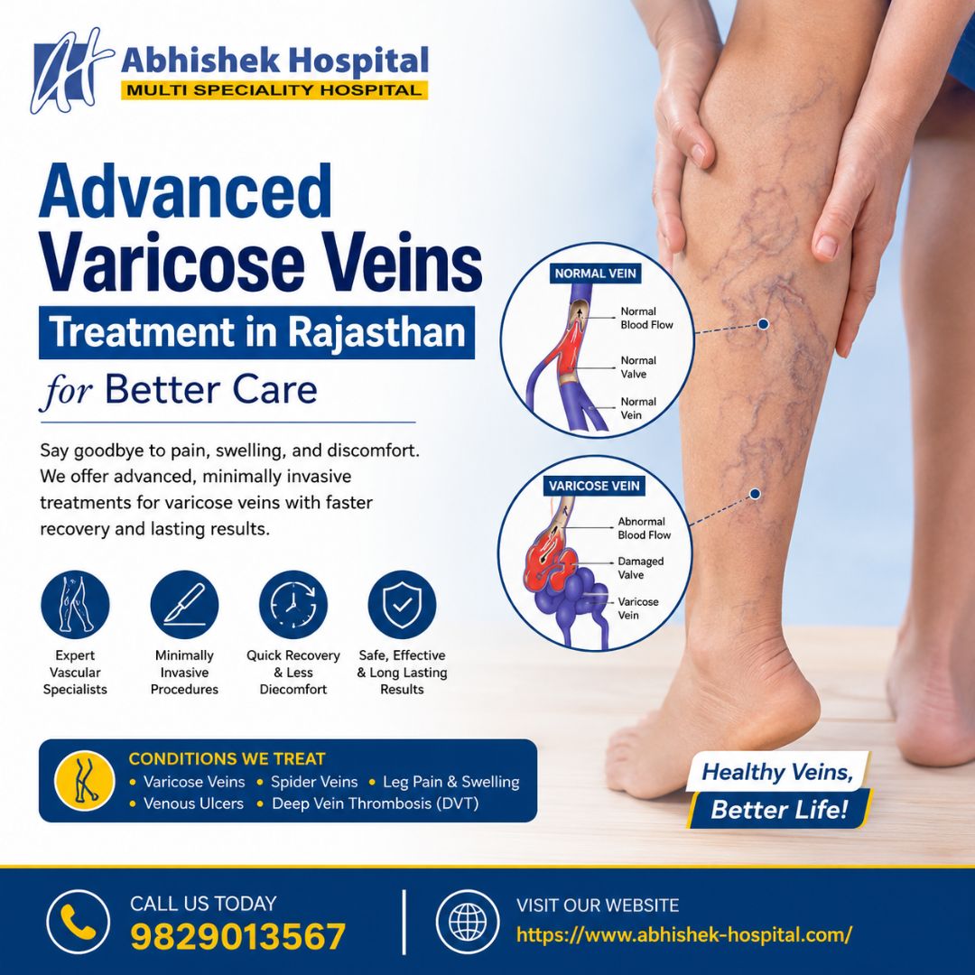  Advanced Varicose Veins Treatment in Rajasthan for Better Care