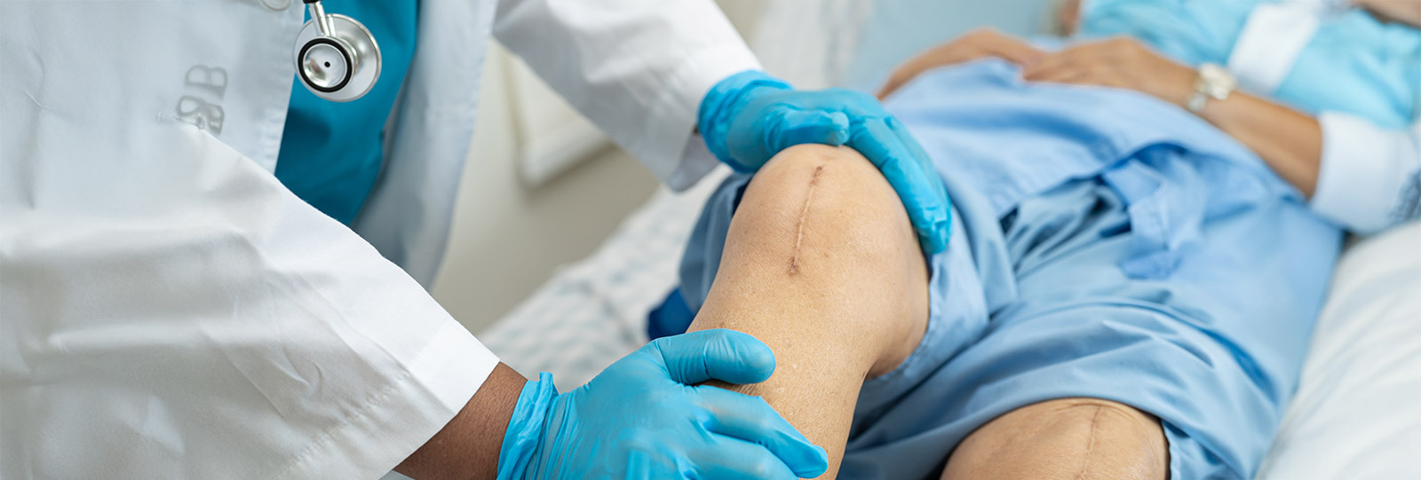  Long-Term Joint Care and Restored Function