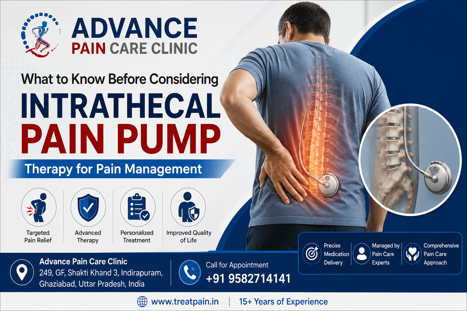  Understanding Intrathecal Pain Pump Treatment for Chronic Pain Relief
