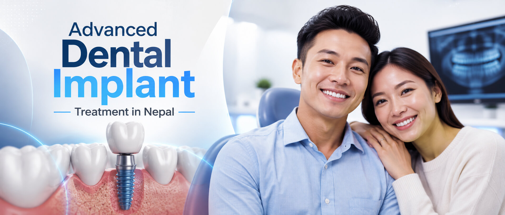  Dental implants in Nepal - Rebuild Your Bite. Restore Your Smile.