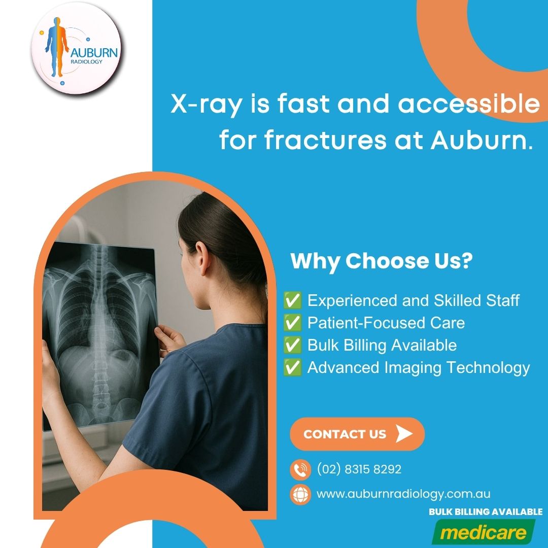  X-ray is fast and accessible for fractures at Auburn Radiology. (02) 8315 8292