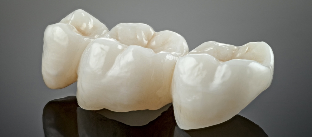  Same-Day Crowns Miami for Fast, Precise Smile Restoration Today