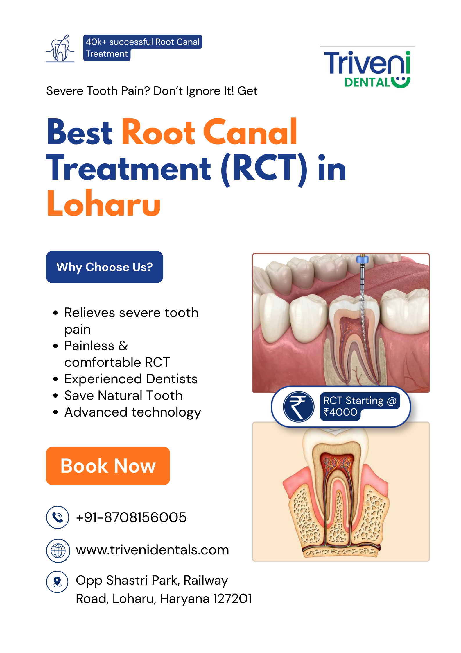  Best Root Canal Treatment in Loharu | Triveni Dental