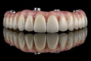  Professional Teeth Whitening Fort Worth for a Brighter Smile