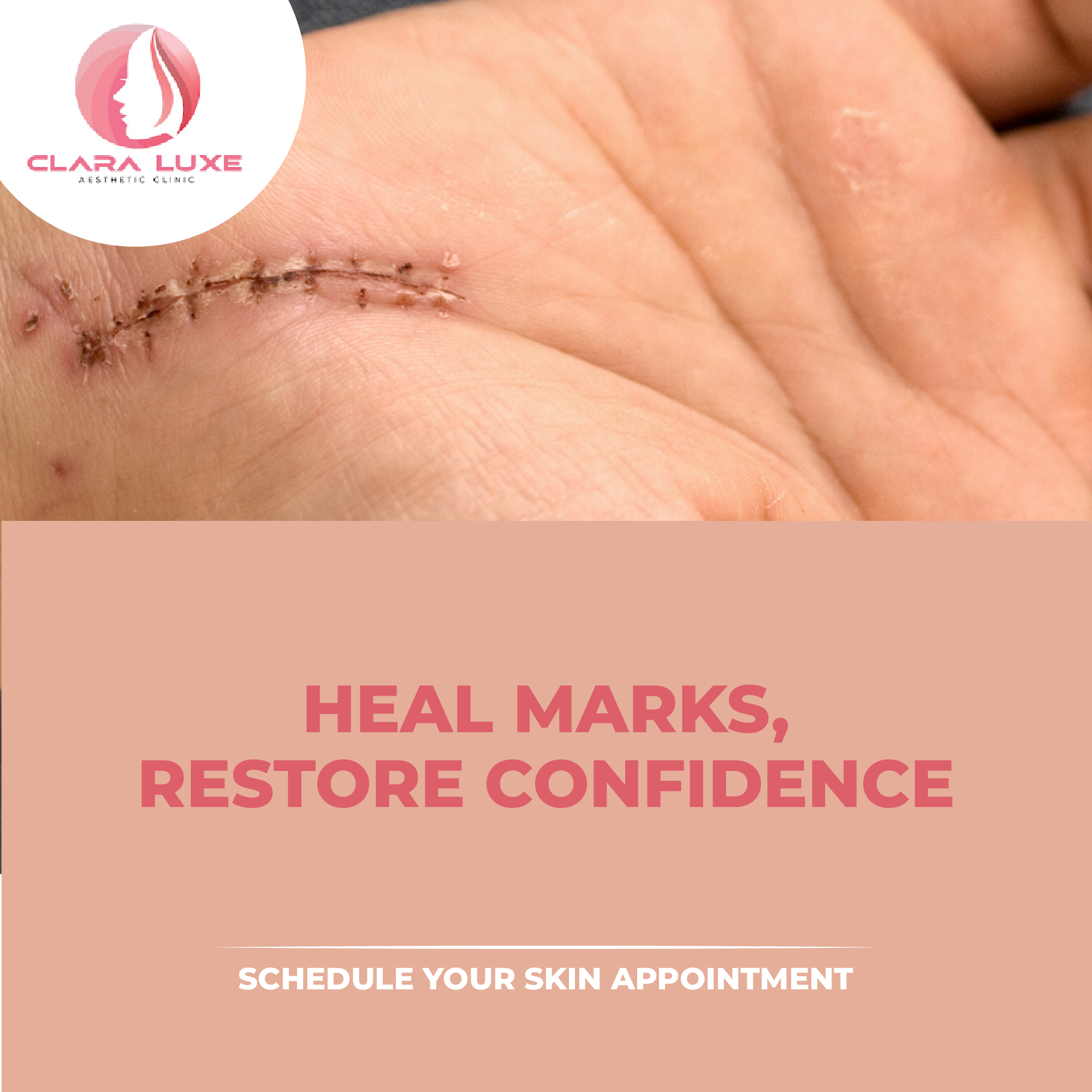  Accidental Scars treatment in Karkardooma