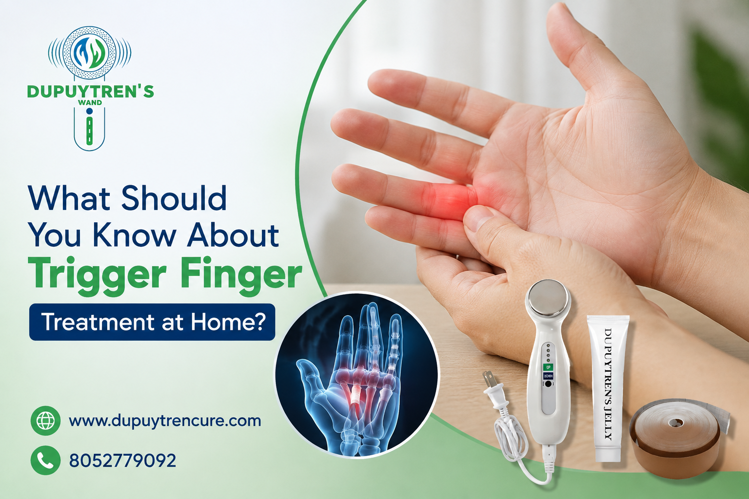  What Should You Know About Trigger Finger Treatment at Home?