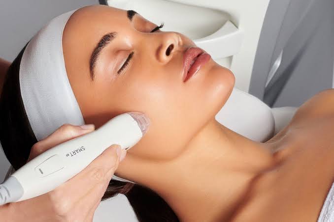  Micro Needling Near Chino Hills for Radiant Skin
