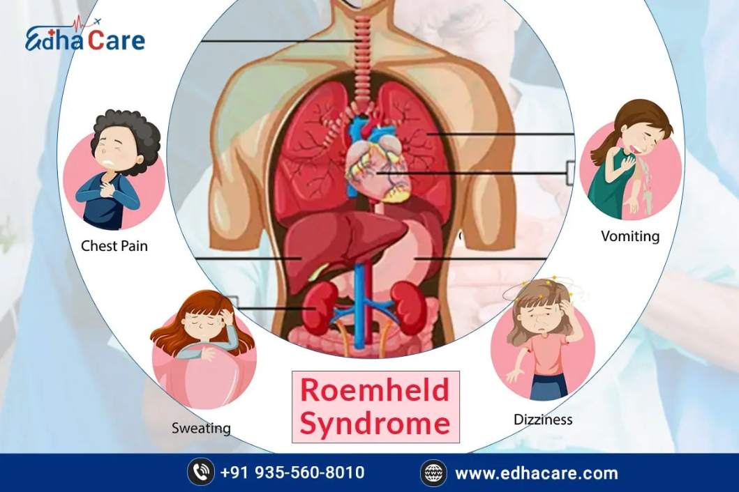  Roemheld Syndrome Treatment | Edhacare Medical Tourism