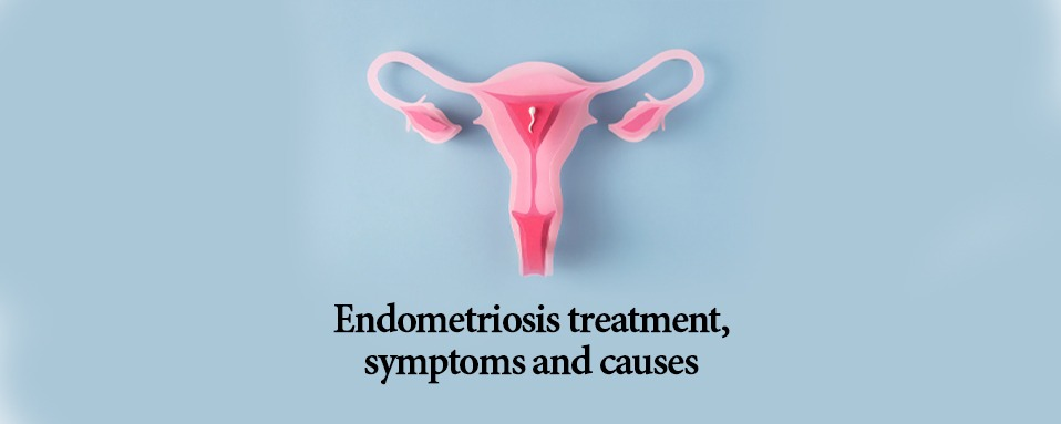  adenomyosis natural treatment in Delhi