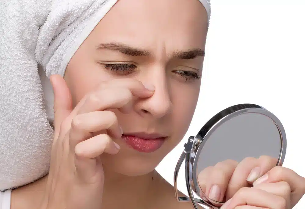 Rhinoplasty in Dubai