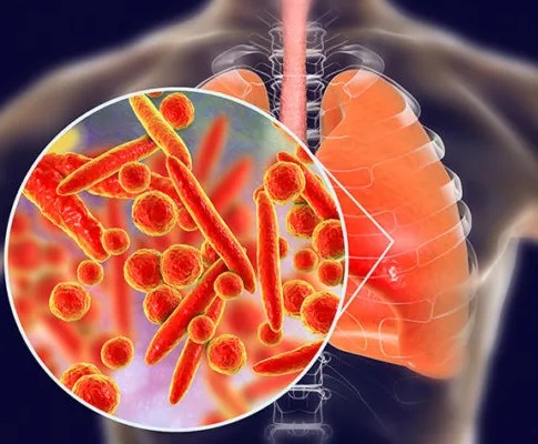 Comprehensive Bronchoscopy & Respiratory Care Doctor in Jaipur, Rajasthan – Dr. Sheetu Singh