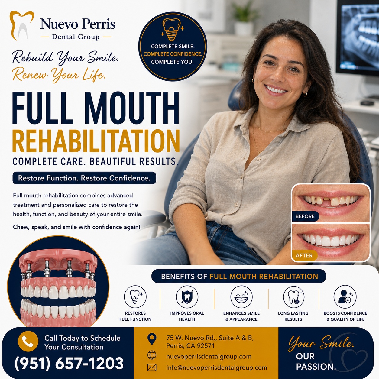  Full Mouth Rehabilitation for Complete Smile - Nuevo