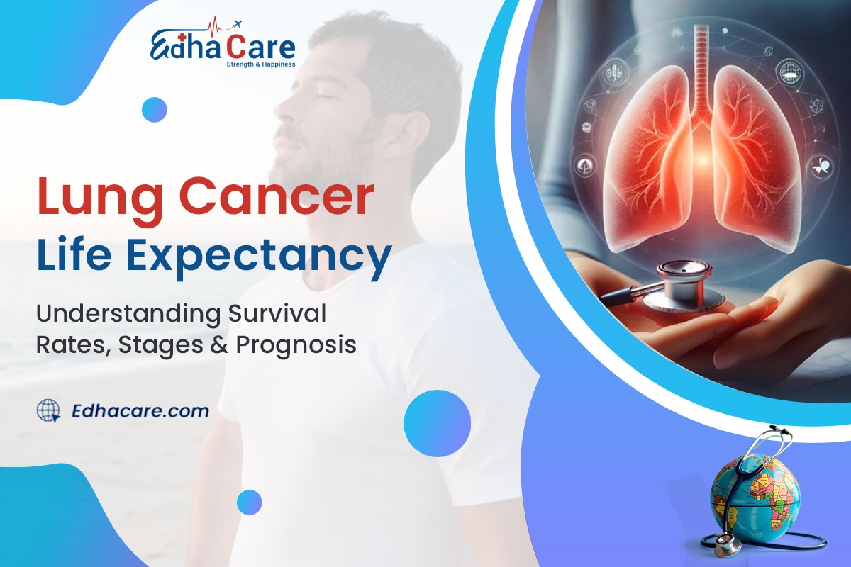 Lung Cancer Life Expectancy by Stage: Survival Rates & Treatment