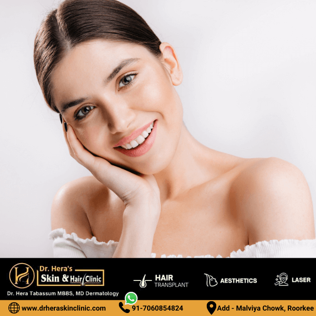  Melasma Treatment in Roorkee