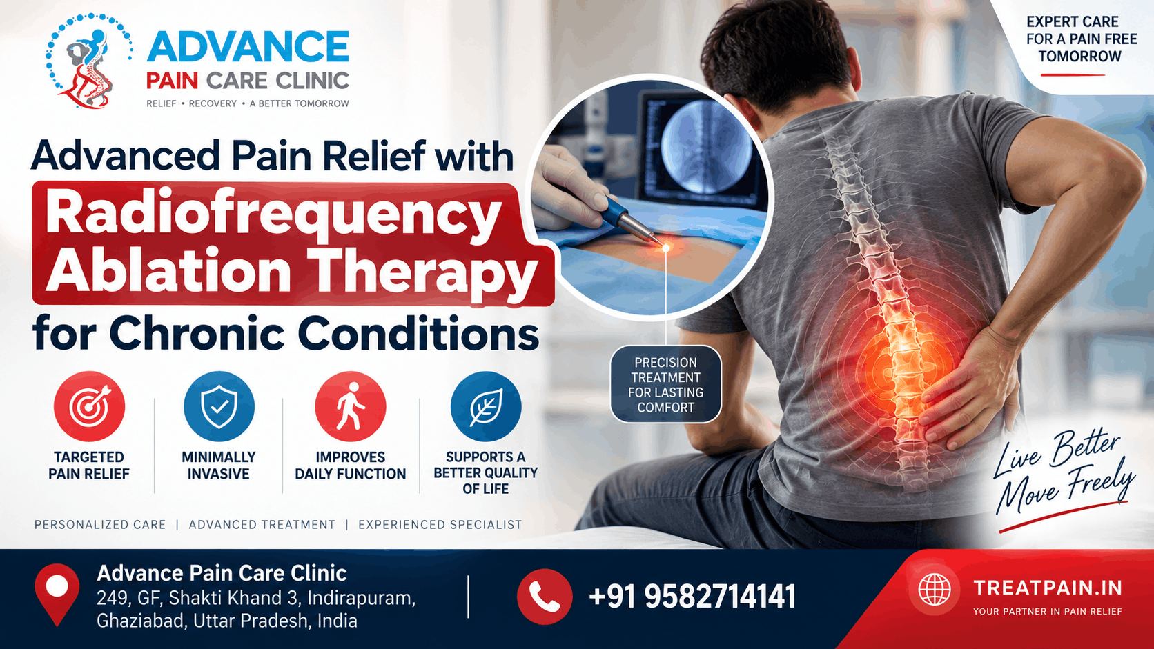  Advanced Radiofrequency Ablation Therapy in Ghaziabad for Pain
