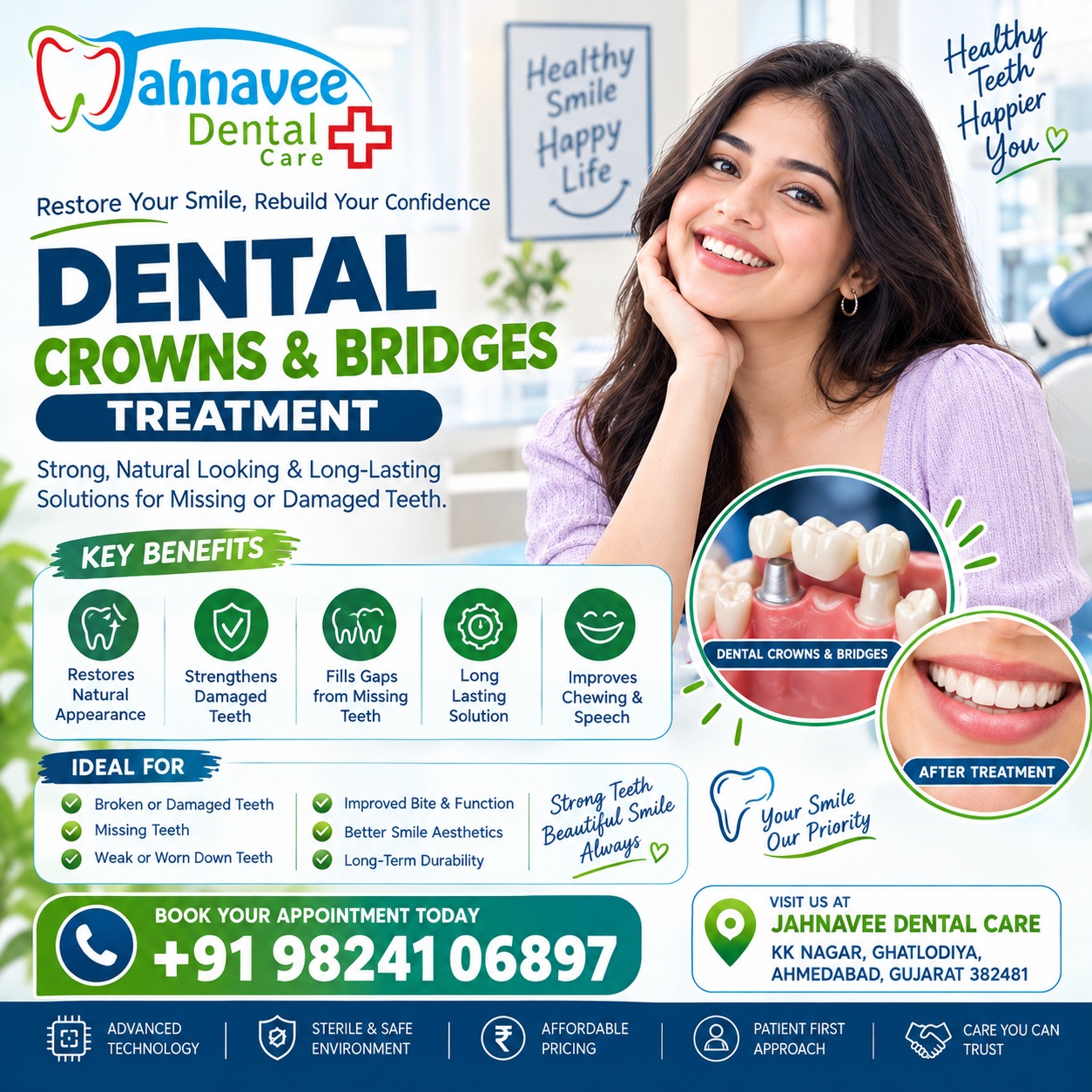  Dental Crowns and Bridges Treatment | Jahnavee Dental Care