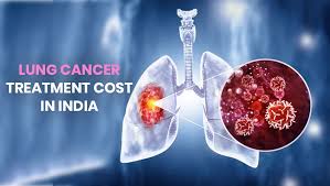  Lung Cancer Treatment Cost in India – Get Treatment Options & Cost | HOSPIDIO